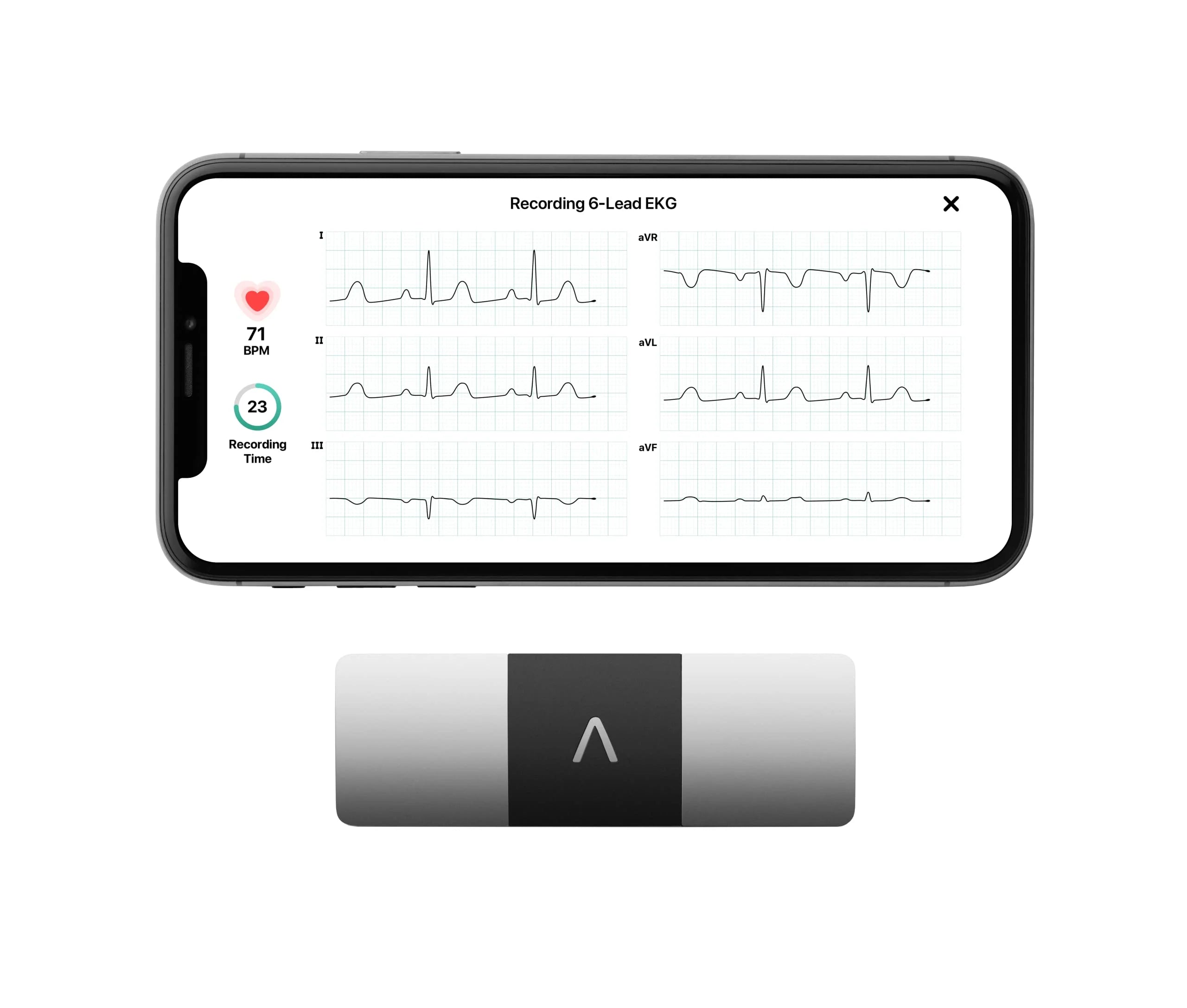 KardiaMobile 6L Personal EKG Monitor with Most Smartphones - Image 2
