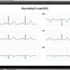KardiaMobile 6L Personal EKG Monitor with Most Smartphones - Image 5