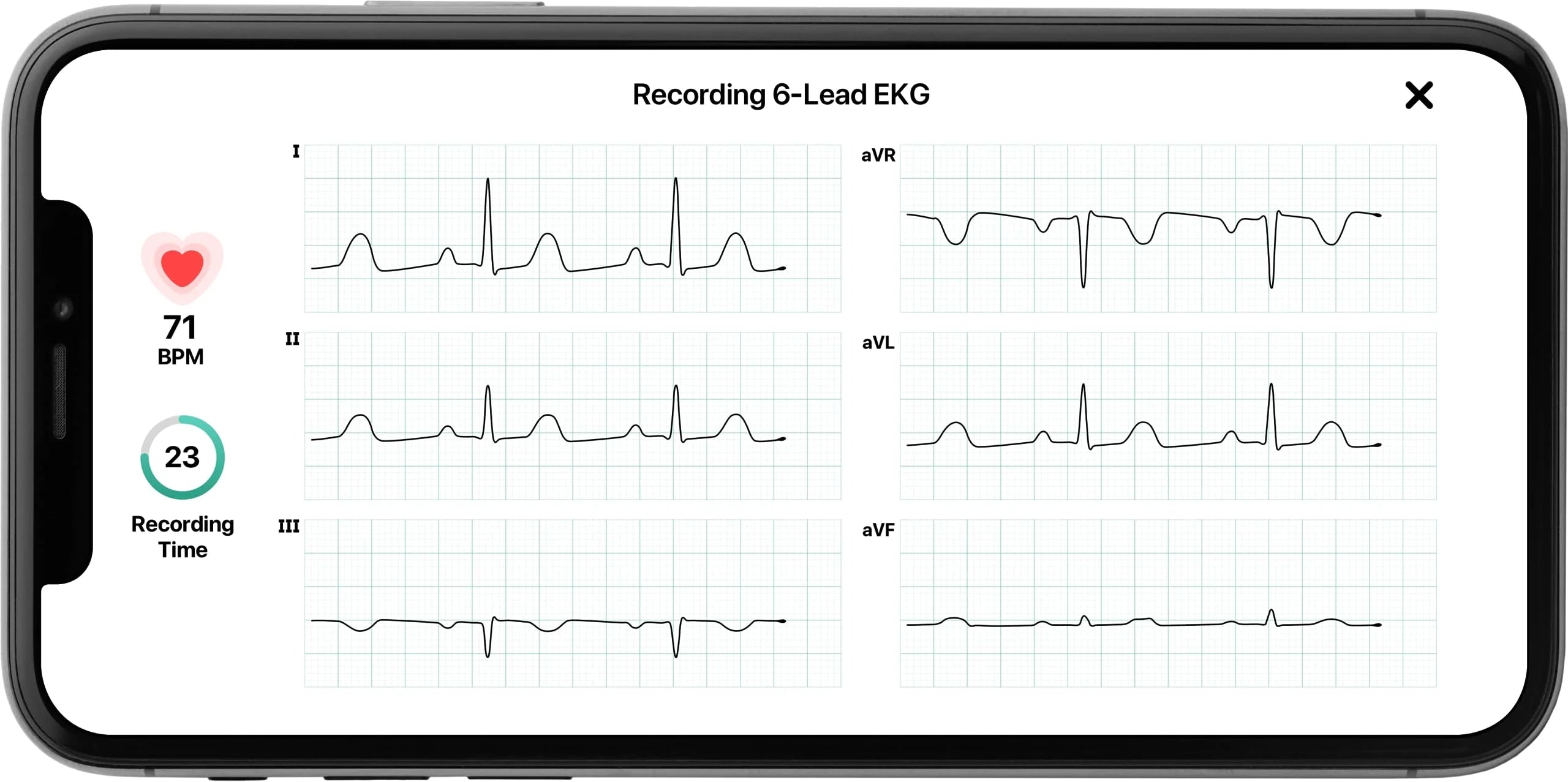 KardiaMobile 6L Personal EKG Monitor with Most Smartphones - Image 5